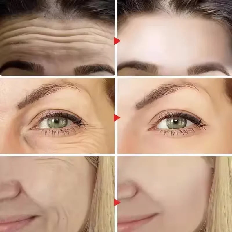 🧴✨ Crema de Retinol Hidratante y Reafirmante